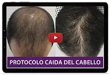 Video Protocolo Caída del Cabello